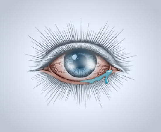 Лечение заболеваний роговой оболочки